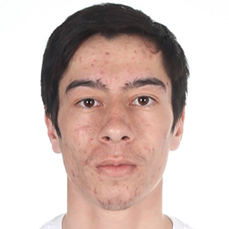 Anvar Anvarov